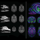 Some of the subtle differences in brain anatomy spotted by Hecht and her team.